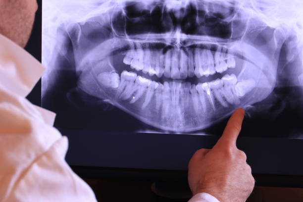 Best Weekend Emergency Dentist in Wellston, OH