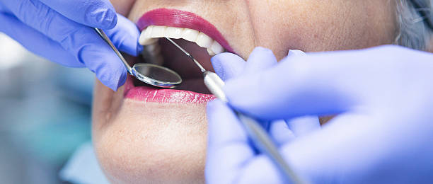 Best Emergency Root Canal Treatment in Wellston, OH
